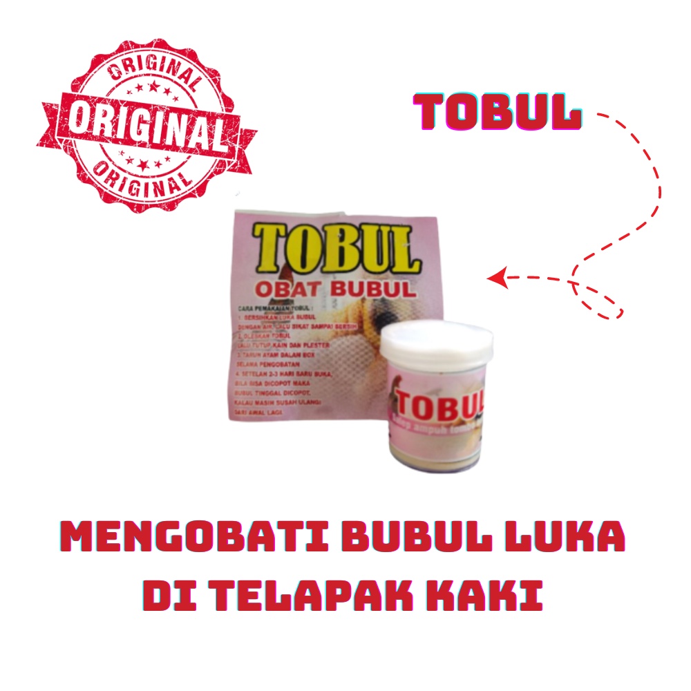 TOBUL OBAT BUBUL - obat BUBUL ayam aduan
