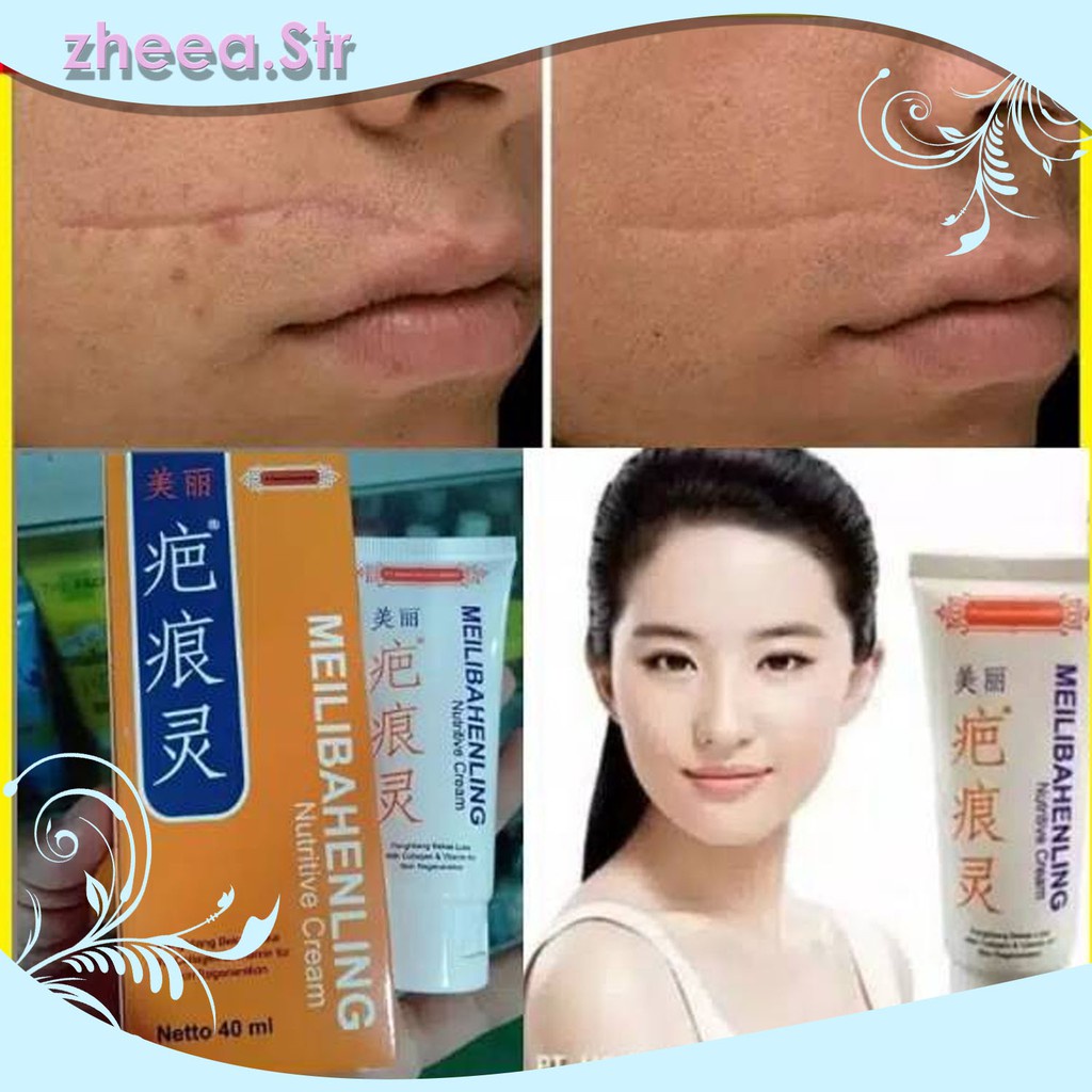 Obat Dermatitis Seboroik di Apotik - Harga Obat Dermatitis di Apotik 100% CEPAT dan AMA