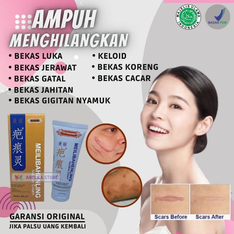 Salep Obat Cream Meilibahenling Penghilang Bekas Luka Lama Hitam Koreng Jerawat Bopeng Melibahenling