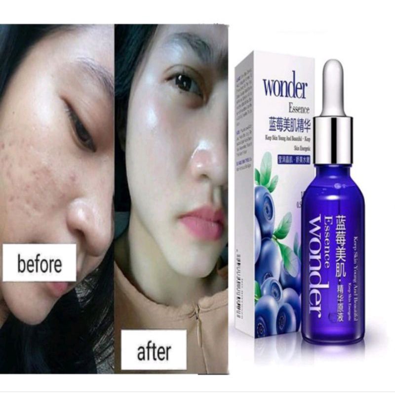 BLUEBERRY WONDER ESSENCE (SERUM MEMUTIHKAN)