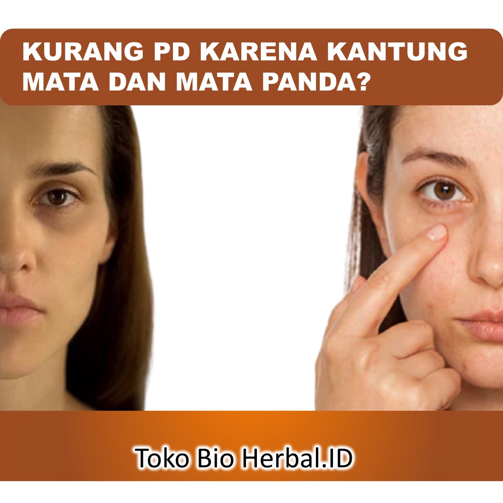 Penghilang Kantung Mata Penghilang Mata Panda Ampuh Krim Mata Panda Eye Treatment B11P