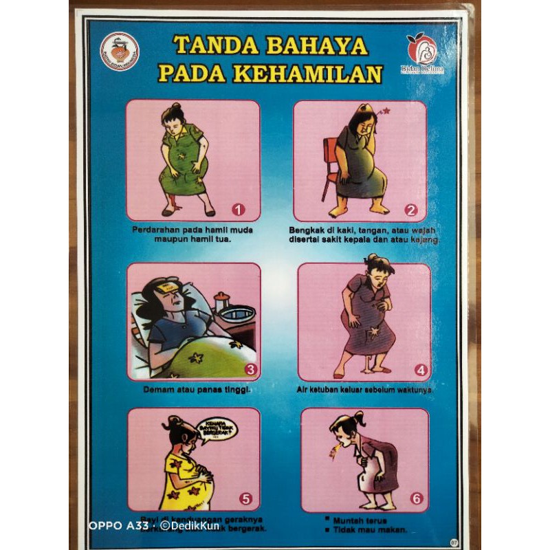 Jual 07 Poster Tanda Bahaya Pada Kehamilan Indonesia Shopee Indonesia