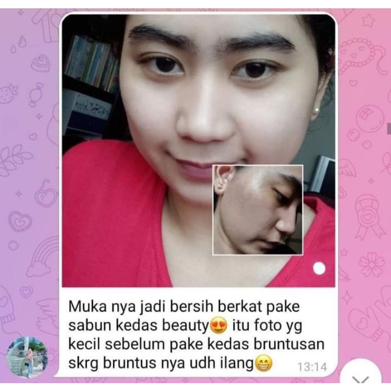 GOLD JELLY kedas beauty-4