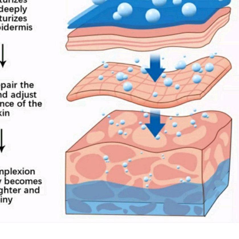 Krim Pemutih Bintik Efektif Niacinamide Menghilangkan Melasma capsme