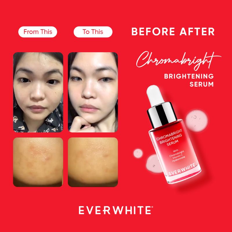 C Everwhite Brightening Essence Serum (Mencerahkan) - ChromaBright 15ml