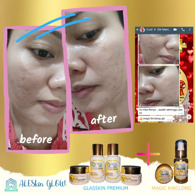 PAKET MAXI GLOW ALESKIN GLOW Skincare Glowing-Paket Perawatan Wajah Korea-Cream Glowing