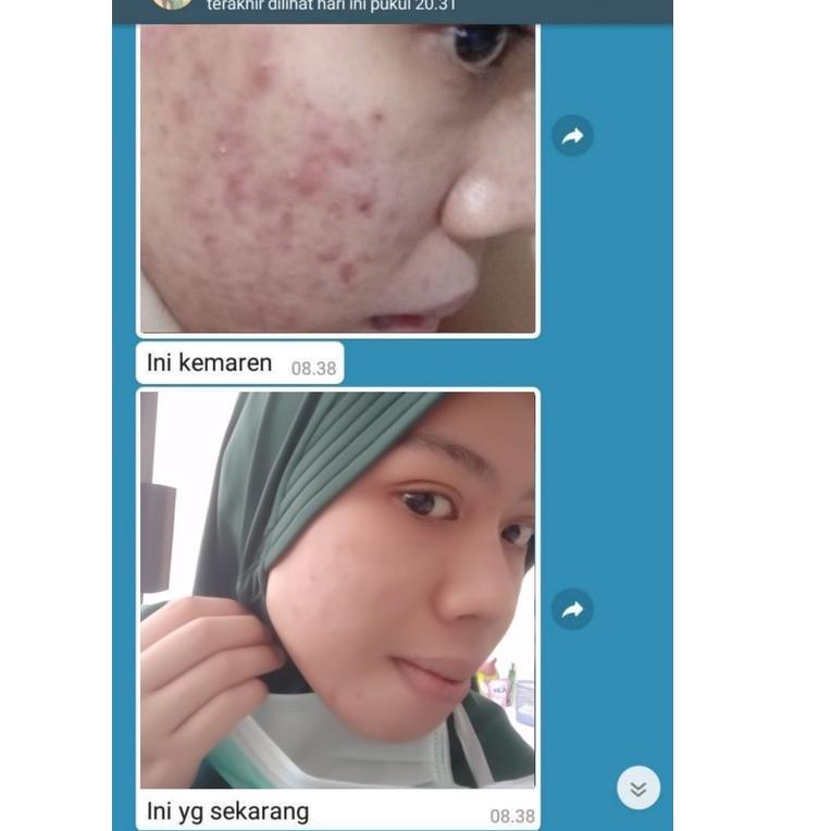G3E3 SERUM ADERA FACE SERUM ORIGINAL WAJAH ORI UNTUK FLEK HITAM GLOWING ORI BPOM ASLI 100% 8CR
