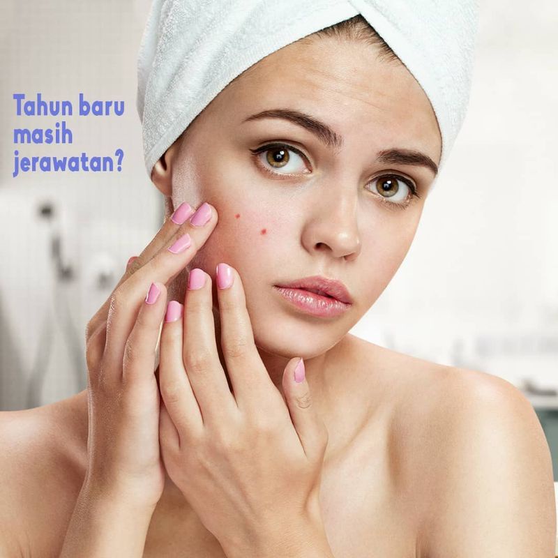 NOURISH ACNE GEL - KRIM PENGHILANG JERAWAT - NOURISH SKIN