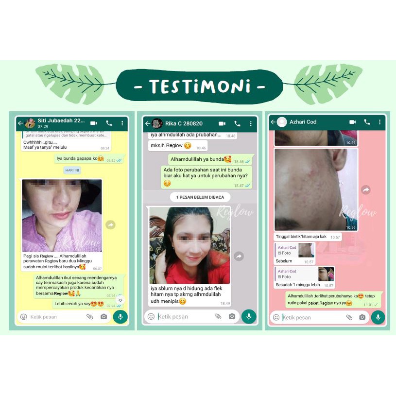 REGLOW CREAM WAJAH JERAWAT REJUVENATING INTENSTIVE CREAM SKIN TREATMENT ORIGINAL BPOM-7