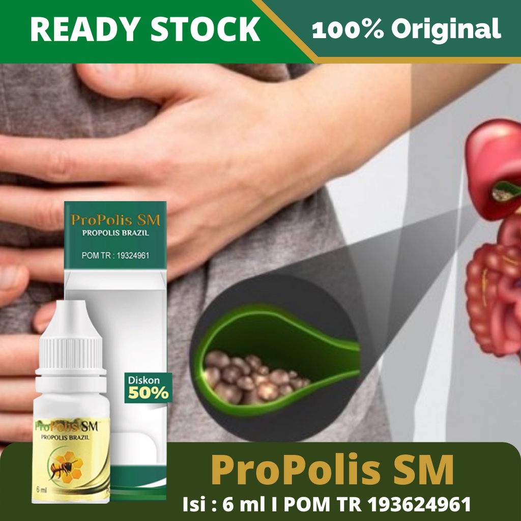 Obat Batu Empedu, Obat Batu Empedu Resep Dokter, Obat Batu Empedu Herbal, Obat Batu Mosehat, Obat Batu Empedu, Obat Penghancur Batu Empedu, Sakit Batu Empedu Cair, Batu Empedu Akut, Kronis, Ringan, Obati Dengan ProPolis SM 100% Original BPOM