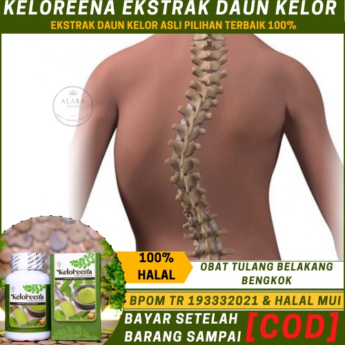 Obat Tulang Belakang Bengkok, Tulang Punggung Melengkung, Tulang Punggung Bengkok Ke Kiri Atau Kanan