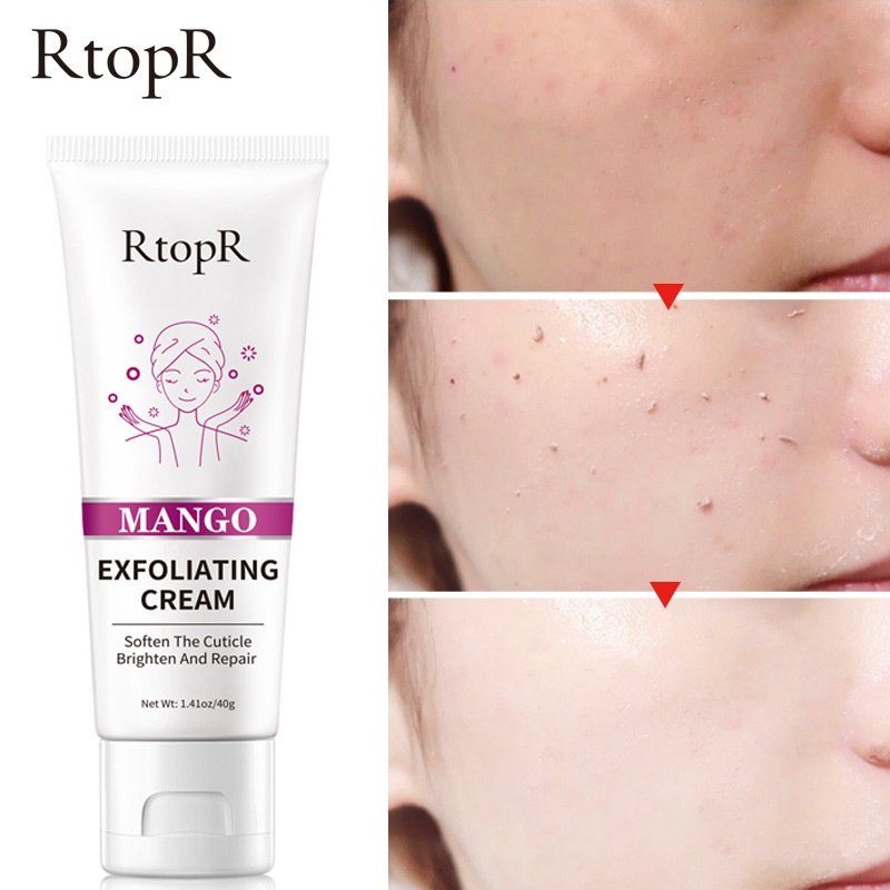 RtopR MANGO Exfoliating Cream Skin Care Whitening Moisturizer Repair Facial Scrub Skin Cleaner Acne Blackhead Treatment Remove Face gel(40g)