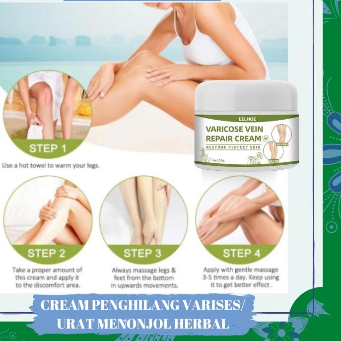 Diskon✔️EFEKTIF Permanen Krim Varises Cream Varises Angiitis Salep Flebitis Kaki Krim Varises|SQ5
