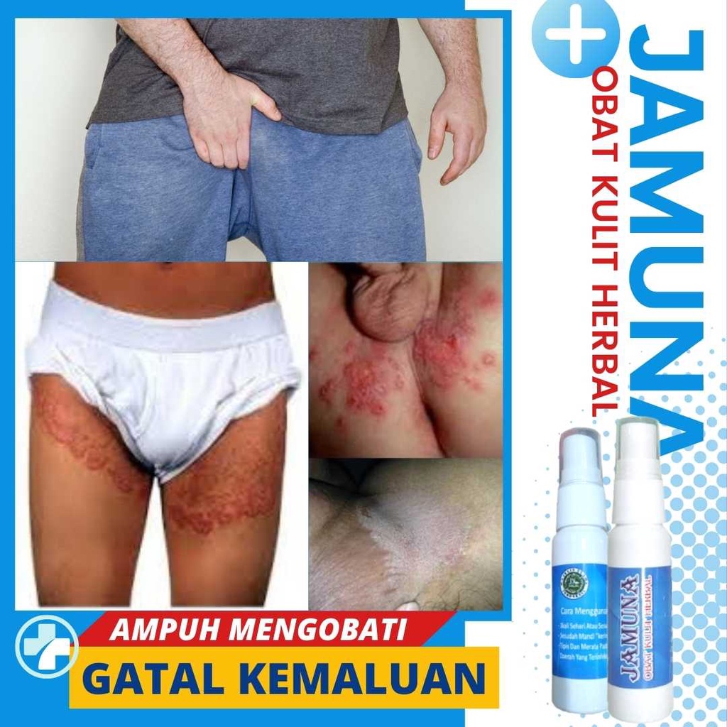 Obat Kulit Gatal Paling Ampuh, Obat Biang Keringat, Jerawat, Kemaluan Kaki Basmi Panu Kurap Jamur Ek