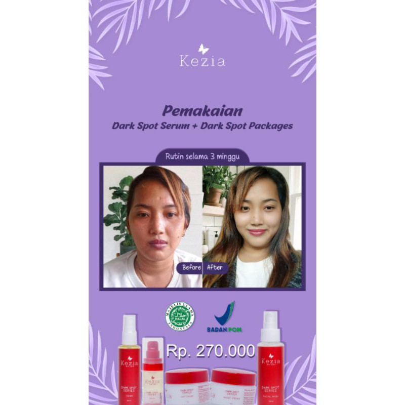 kezia skincare