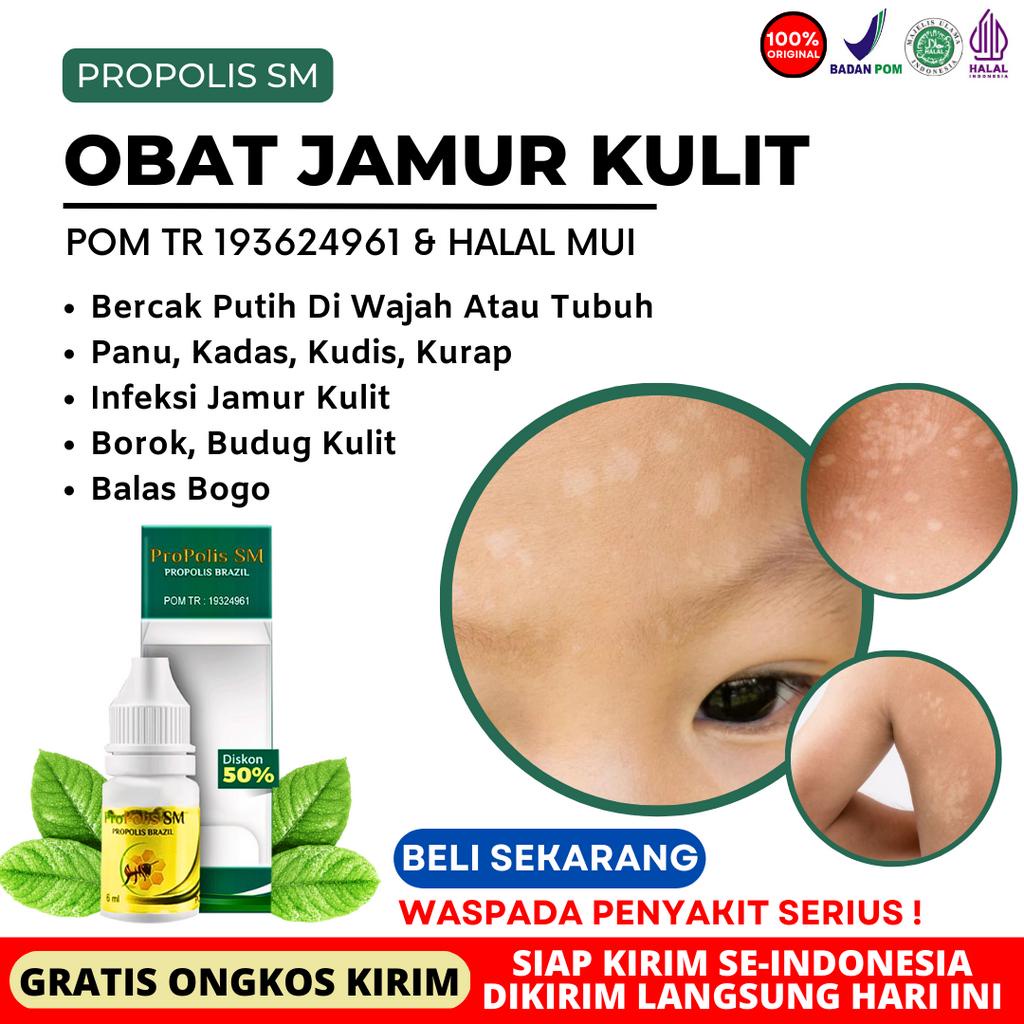 { GRATIS ONGKIR } Obat Balas Bogo - Obat Balas Bogo Anak - Obat Salep Balas Bogo di Apotik - Obat Pe