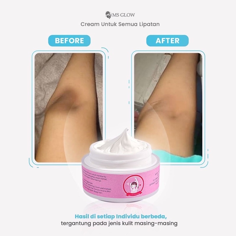 MS Glow Underarm Cream 15gr Krim Ketiak Lipatan Hitam MSGLOW Beauty