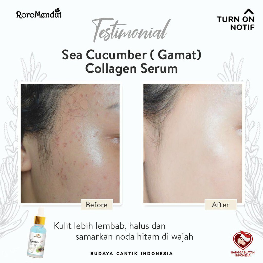 Serum Wajah Original Natural Roro Mendut Glowing Bpom Murah Penghilang / Bekas Jerawat Pria Wanita