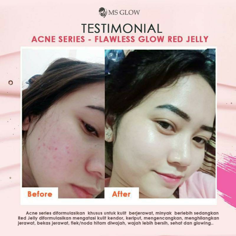 [COD] MS GLOW PAKET WAJAH/+ SERUM [SERUM TERJUAL TERPISAH DARI PAKET WAJAH]