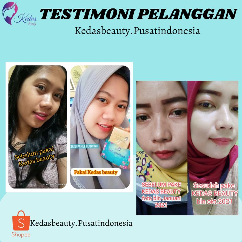 Sabun Kedas Beauty Original BPOM Sepaket Gold Jelly Kedas Beauty Pemutih Wajah Murah Cod-6