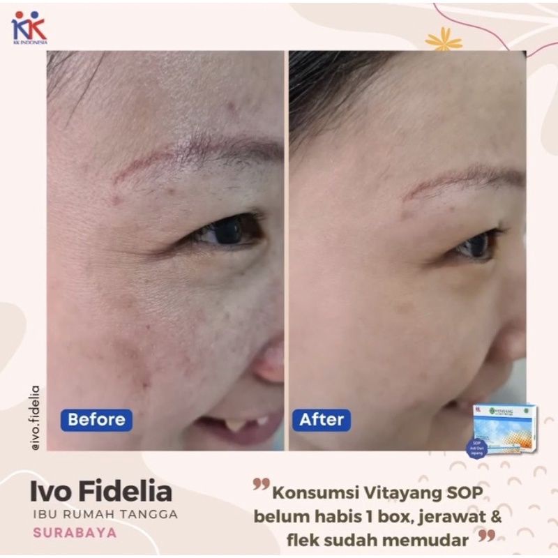 Vitayang SOP Salmon Ovary Peptide Minuman Kecantikan dari Jepan Menghilangkan Flek jerawat Mencerahkan wajah Suplemen Kesehatan Collagen Original KK Indonesia