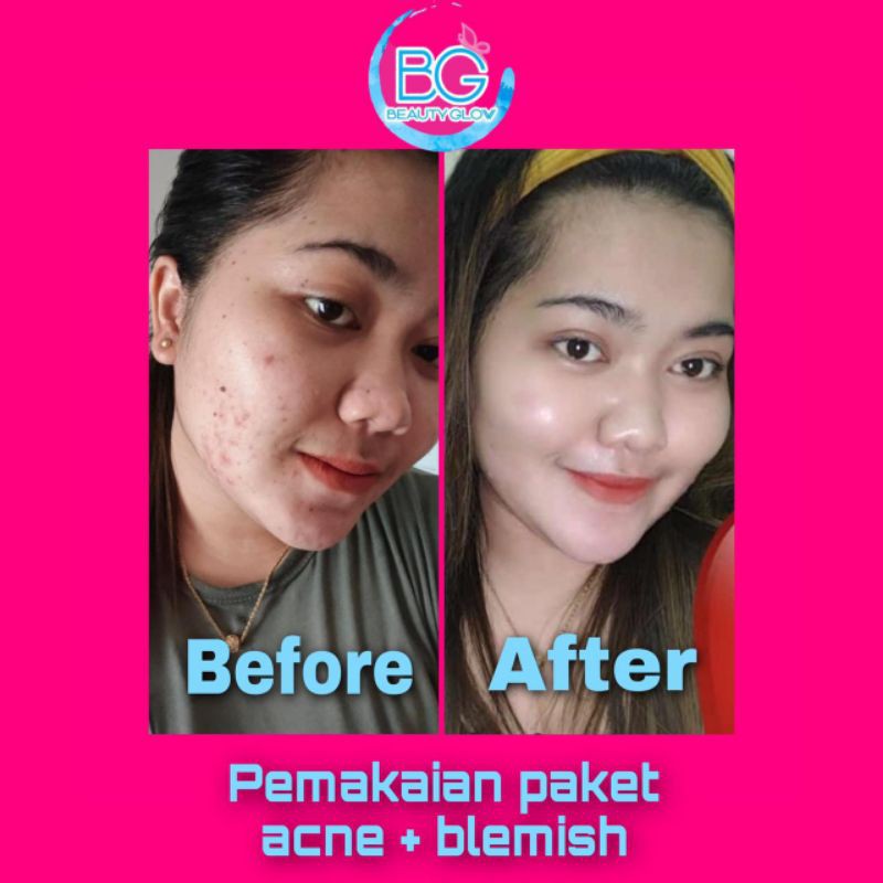 Beauty Glow Skincare Apakah Aman ~ news word
