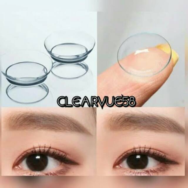 Softlens bening