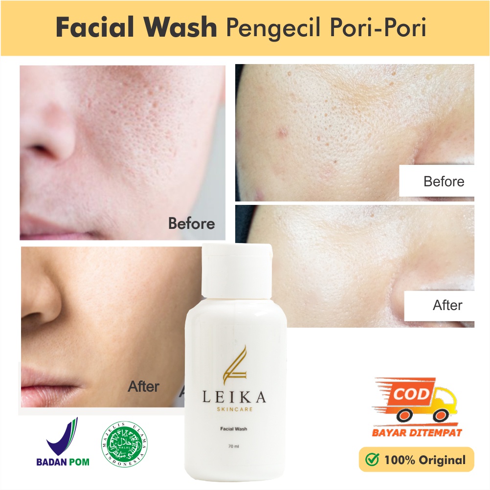 Terlaris Sabun Muka Pengecil Poripori Wajah Pria Wanita Ampuh Mengecilkan Poripori Wajah Dan Komedo 