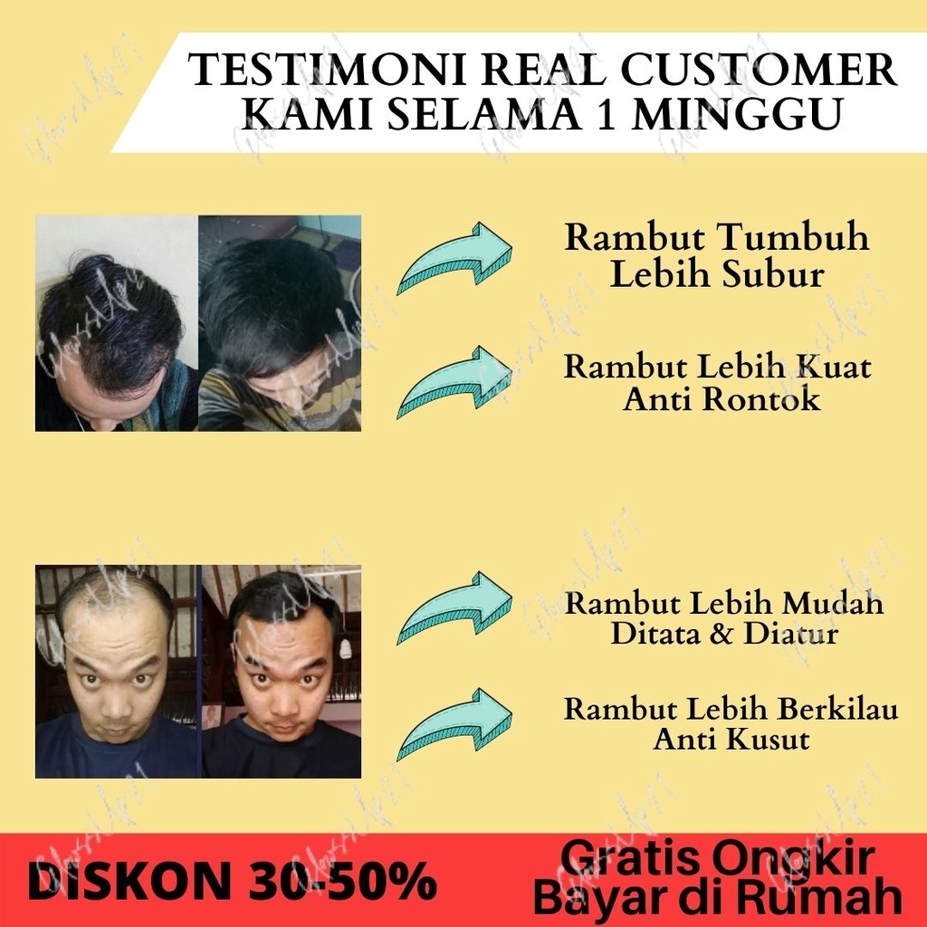 HAIR TONIC KEMIRI BMKS - HAIRTONIC PENYUBUR RAMBUT - PENUMBUH RAMBUT BOTAK