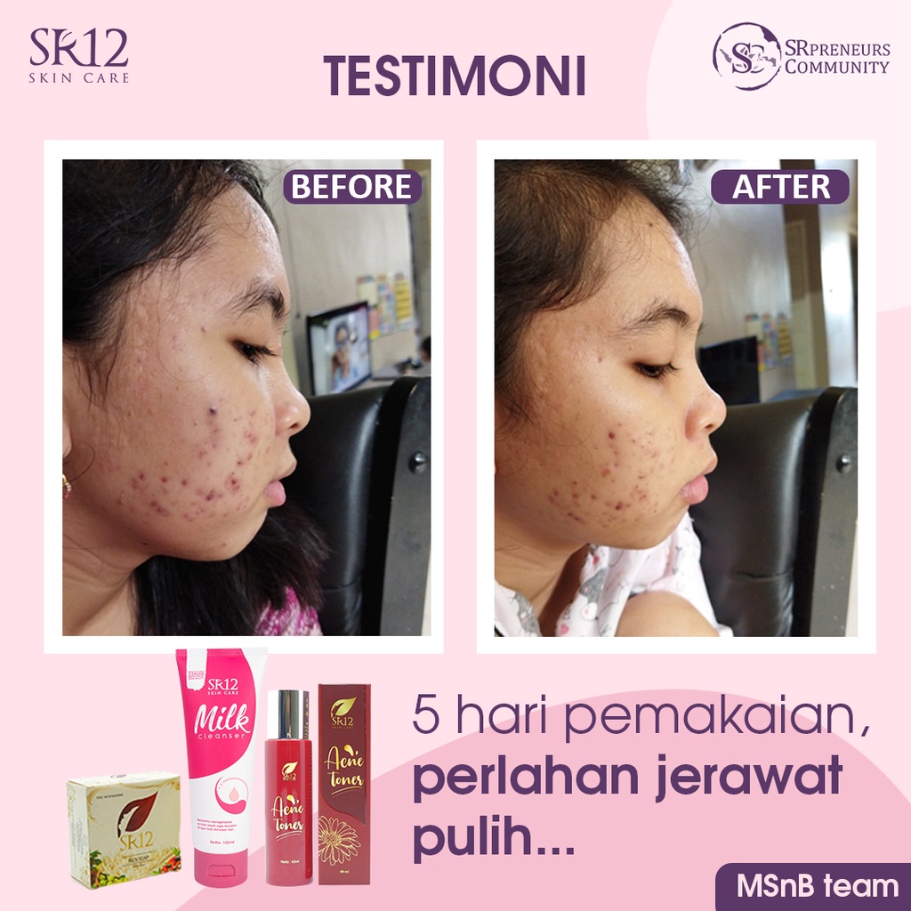 SABUN BERAS HERBAL SR12 | RICE SOAP | SABUN JERAWAT BPOM | KULIT BERMINYAK &amp; SENSITIF BPOM