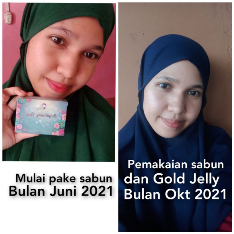 PAKET LENGKAP KEDAS BEAUTY PAKET COMPLETE FREE GIFT