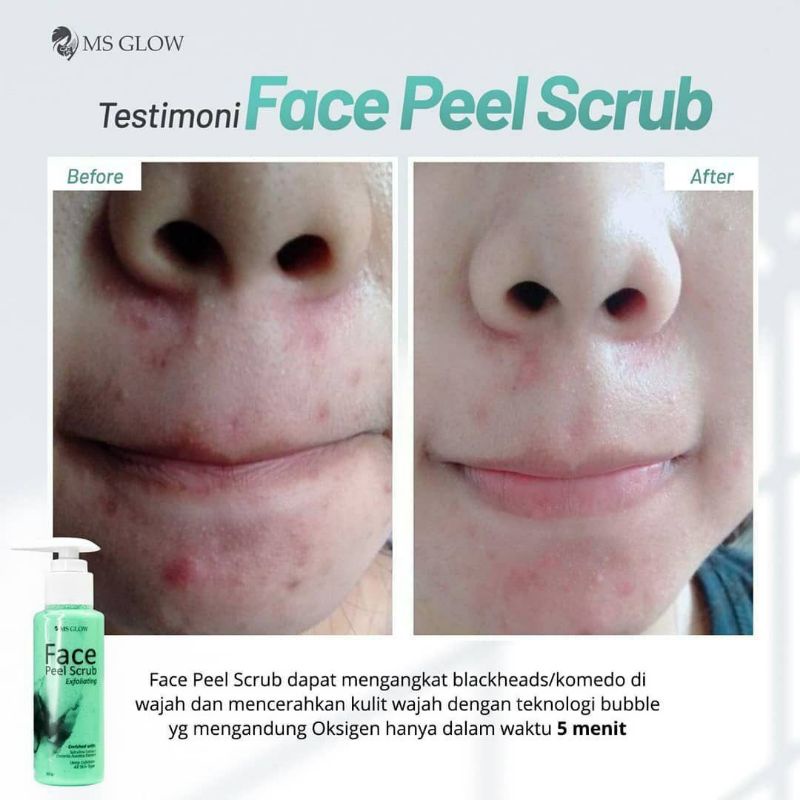 Face Peel scrub Ms glow FACE PEEL SCRUB MSGLOW FACE PEEL KOMEDO