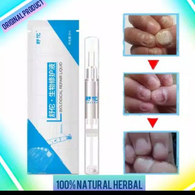 Obat penghilang jamur kuku