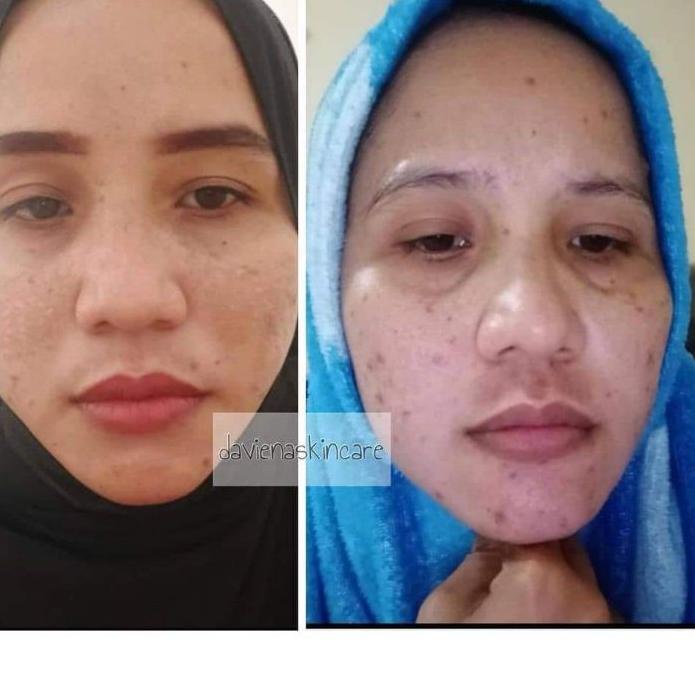 [_064] 4.4 (Pusat Jawa)Daviena Skincare|GOLD SERIES|PEMUTIH WAJAH BPOM DAVIENA SKINCARE|DAVINA SKINC
