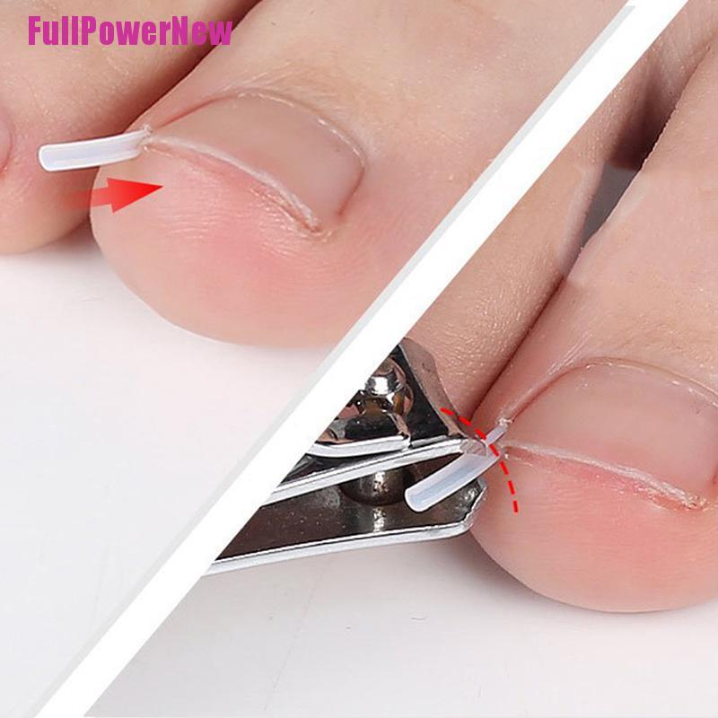 [Full] 10pcs Toenail Straightening Clip Ingrown Toenail Correction Nail Patch Sticker