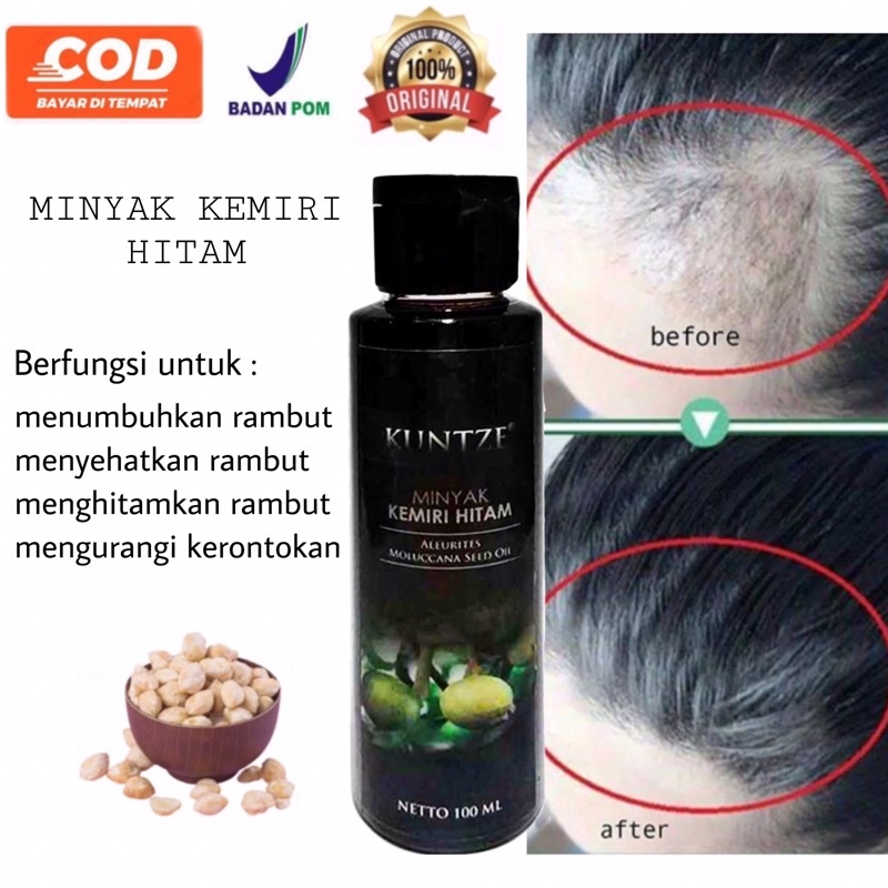 (BPOM) MINYAK KEMIRI PENUMBUH RAMBUT BOTAK PENUMBUH BREWOK PENUMBUH ALIS