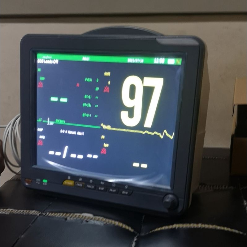 bedside monitor murah Pasien monitor murah 5 parameter