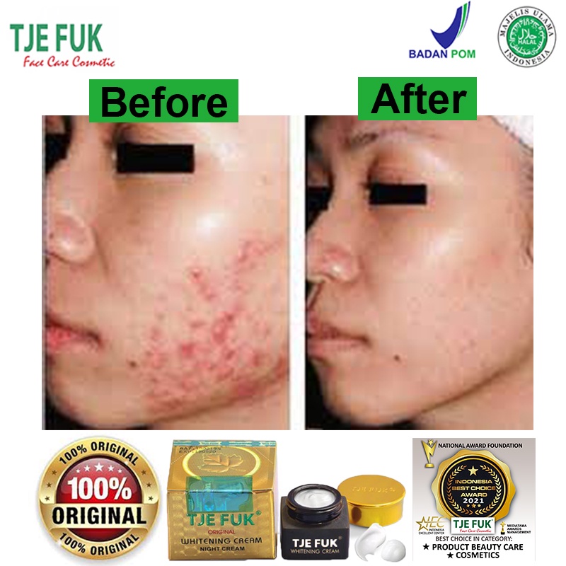 TJE FUK Whitening Night Cream Wajah Glowing Asli Krim Pemutih Malam 100% Original Aman BPOM 15g