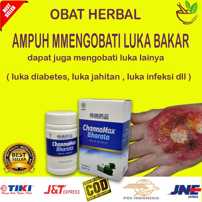 Obat Herbal Obat Luka Diabetes Luka Bakar Luka Luar Dalam Channamax Bharata Bisa Cod Bayar Di Tempat Shopee Indonesia