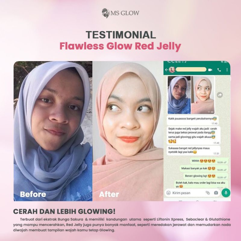 Paket Ultimate + Red Jelly Lactobacillus || MS GLOW