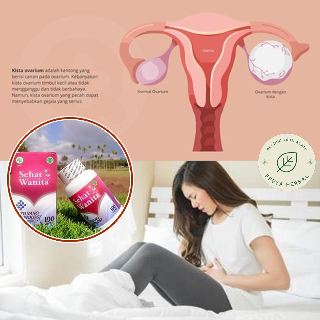 OBAT KISTA OVARIUM, OBAT KISTA RAHIM, OBAT KISTA INDUNG TELUR