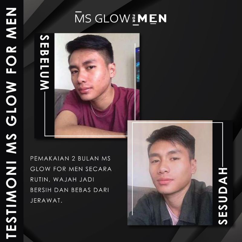 MSGLOW MEN PAKET LENGKAP MSGLOW FOR MEN SKINKER SEKINKER SCINCER SECINCER SCINKER SCINCARE SKINCARE WAJAH PRIA GLOWING PEMUTIH WAJAH PRIA JERAWAT ORIGINAL-4