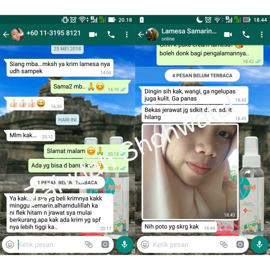 Cream Pemutih Wajah Yang Aman Buat Ibu Hamil