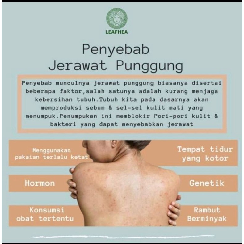UNTUK SEMUA KELUHAN KULIT,DARI FLEK HITAM,JERAWAT,BEKAS JERAWAT,KADAS,KURAP,KUTU AIR,PANU,KUDIS,KURA