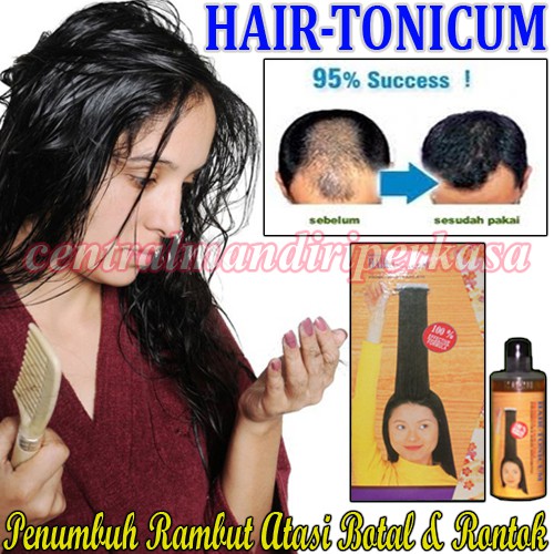 nutrisi penghilang kebotakan penambah cairan penumbuh rambut Obat Penumbuh Rambut Hair Tonikum Asli