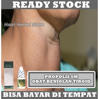 Obat Kanker Payudara 100% Dari Bahan Alami, Obat Payudara Bengkak, Obat Nyeri Payudara, Obat Benjolan Payudara, Obat Tumor Payudara, Obat Daging Tumbuh payudara, Obat Kista Payudara - Propolis SM Brazil