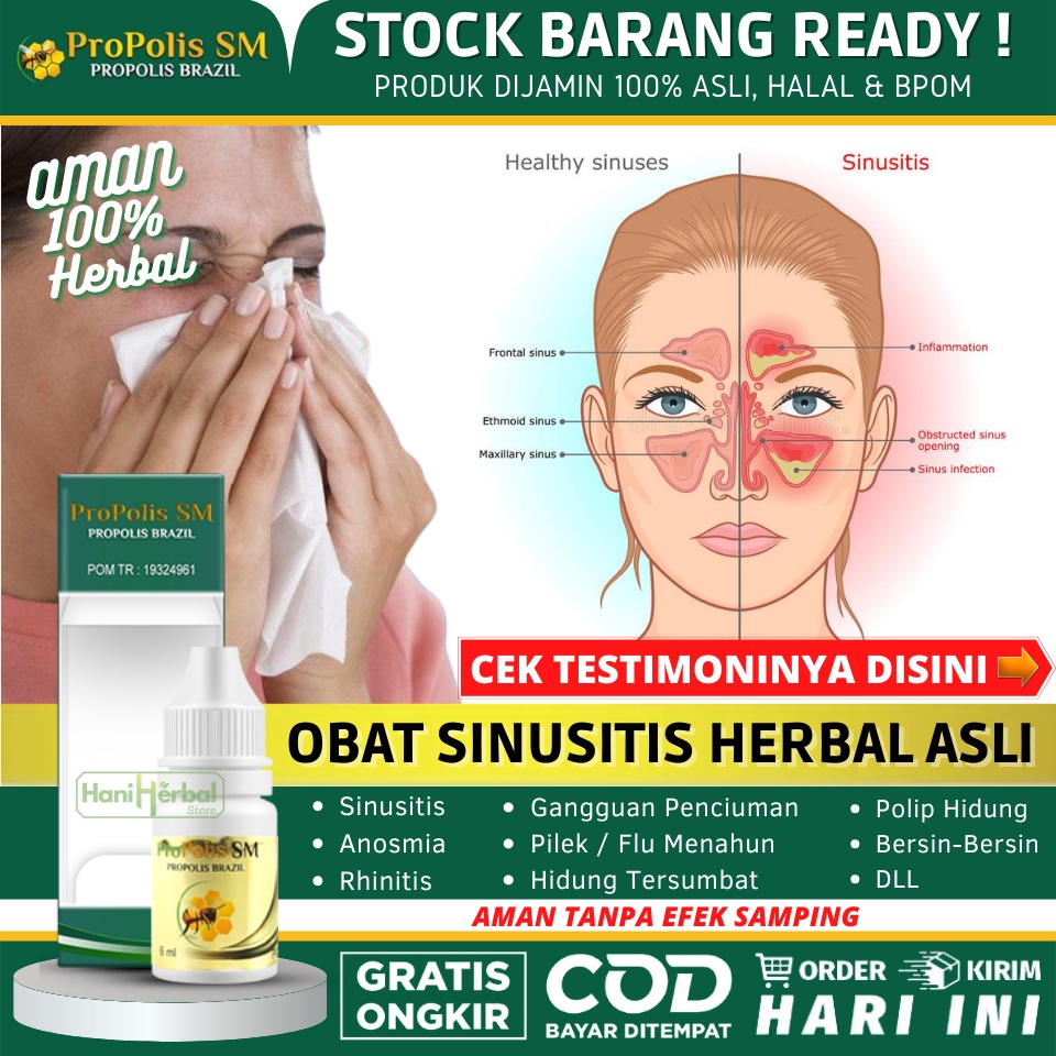Obat Sinusitis Untuk Anak & Dewasa 100% Alami, Obat Hidung Berlendir, Hidung Keluar Cairan Hijau / K