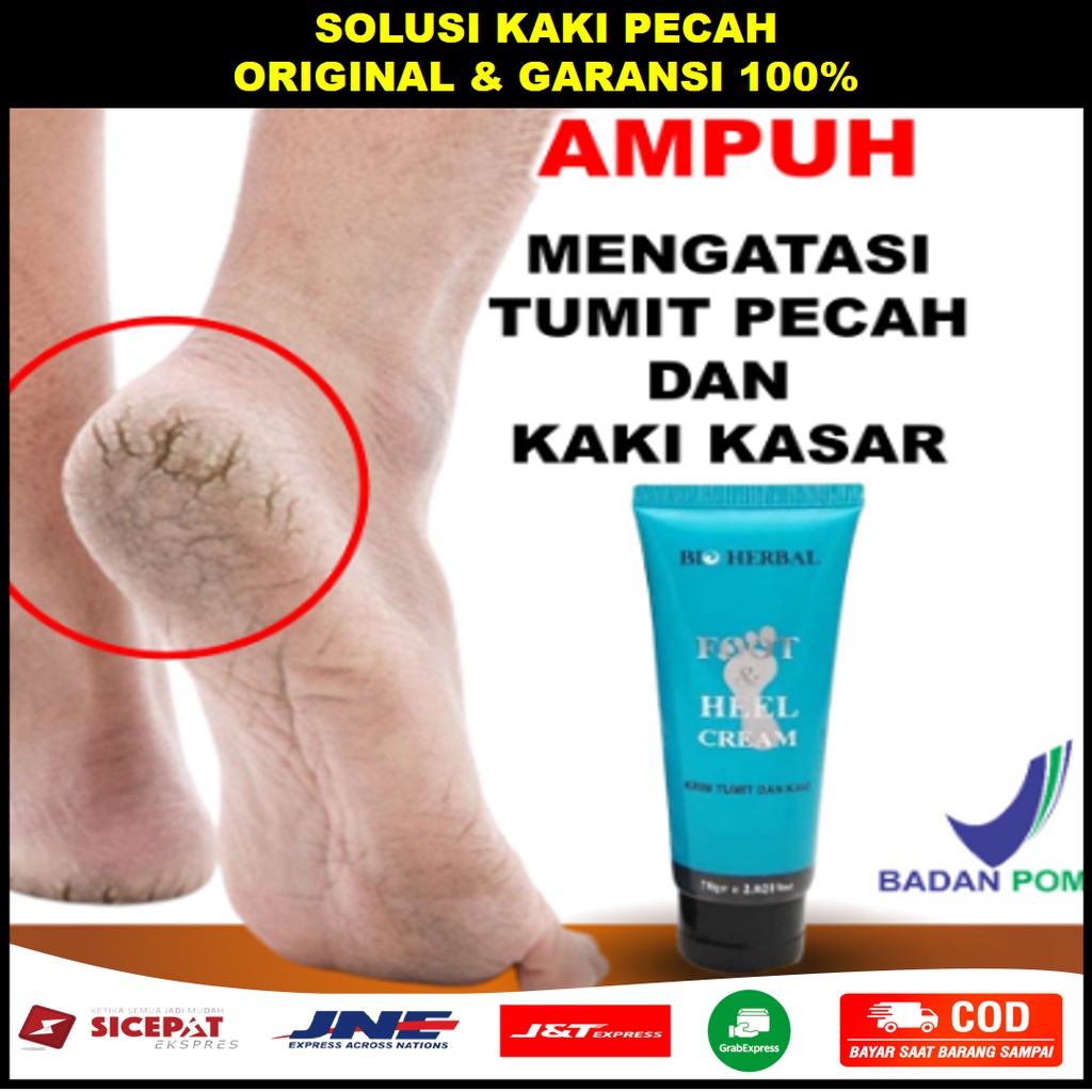 Jual Obat Kaki Pecah Dan Kering Foot Cream Penghalus Tumit Kaki Cream