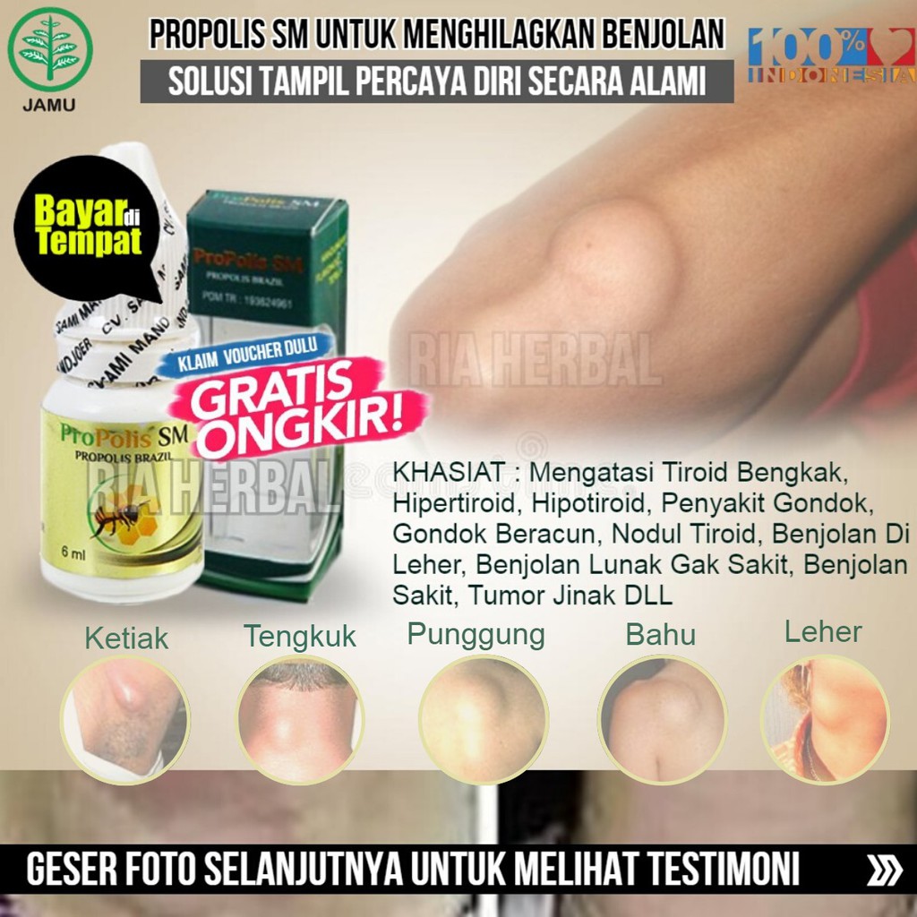 Obat Kelenjar Getah Bening Tiroid Di Leher Ketiak Tangan Benjolan Jinak Tumor Berpindah Pindah Shopee Indonesia