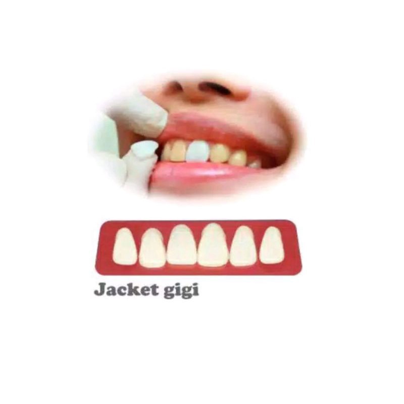 viner gigi kelinci isi 6